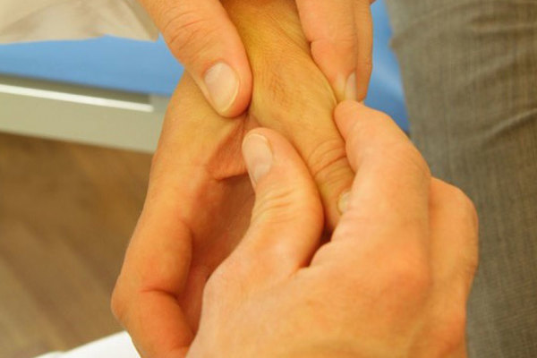 Common Conditions And Injuries Nick Antoniou Hand Therapy 6610